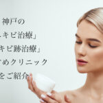 神戸/兵庫のニキビ治療・ニキビ跡治療おすすめ！人気で安い美容皮膚科や口コミを紹介　